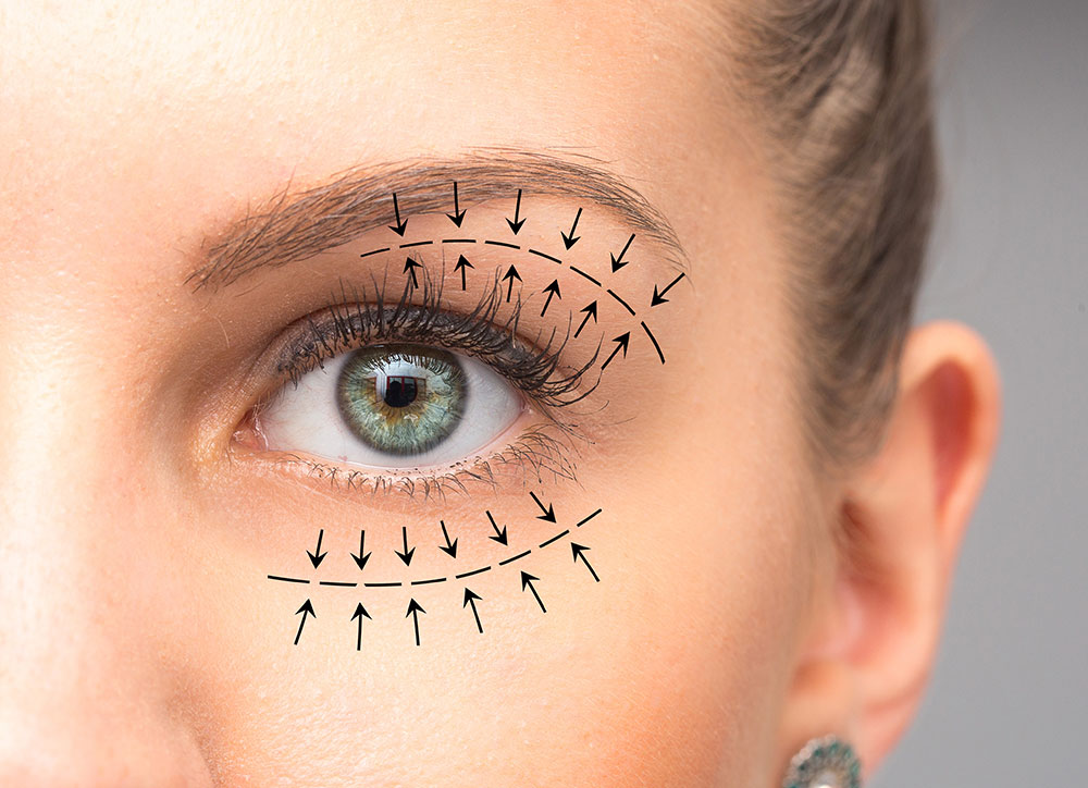 droopy eyelids treatments