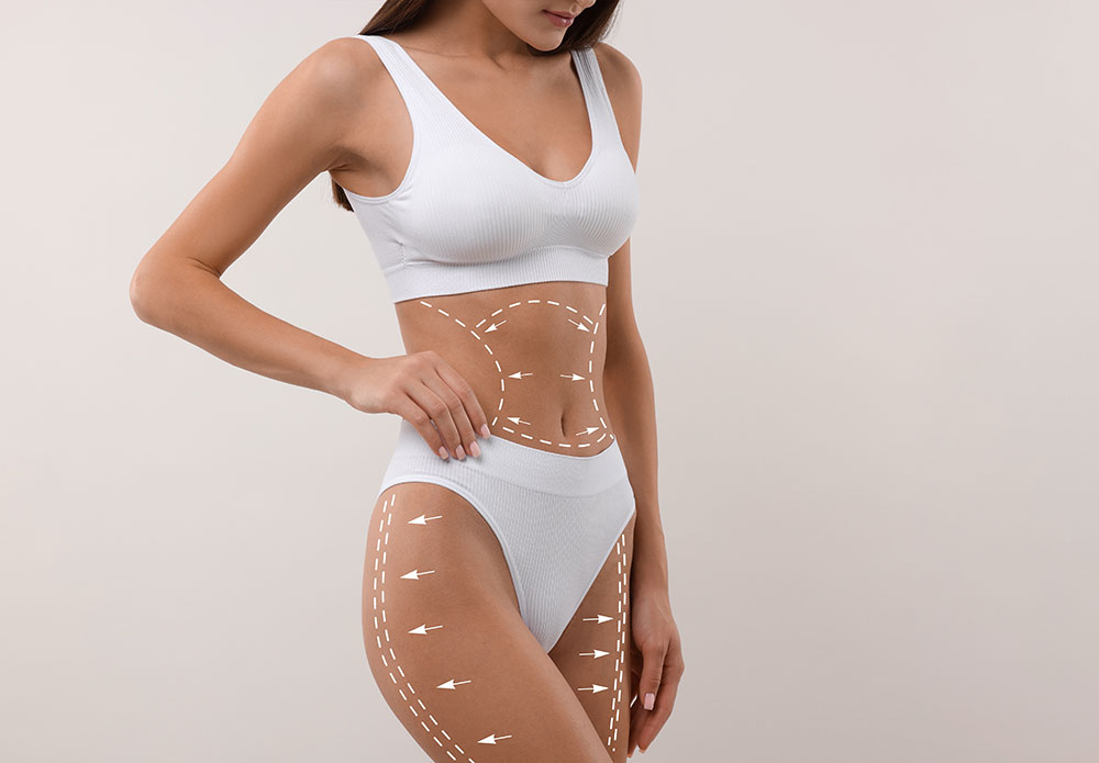 which areas can be treated with liposuction